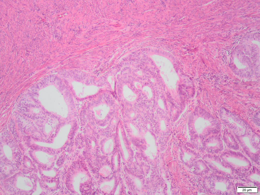 BONE AND SOFT TISSUE PATHOLOGY UNIT.